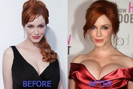 A before and after picture of Christina Hendricks showing her changing breasts.